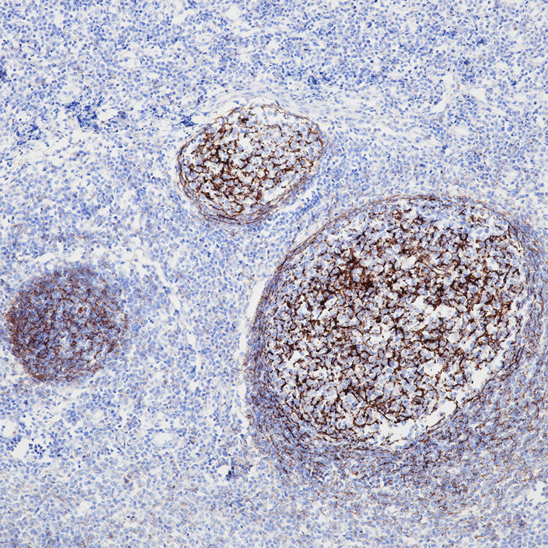 Anti-CD35 Rabbit Monoclonal Antibody