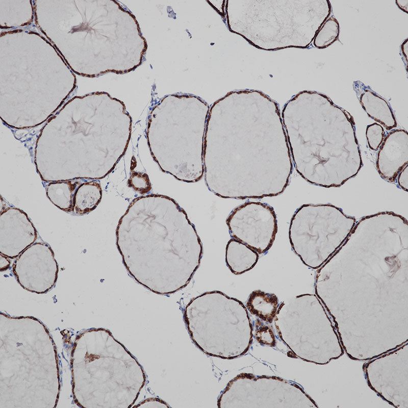 Anti-Thyroid Peroxidase Rabbit Monoclonal Antibody