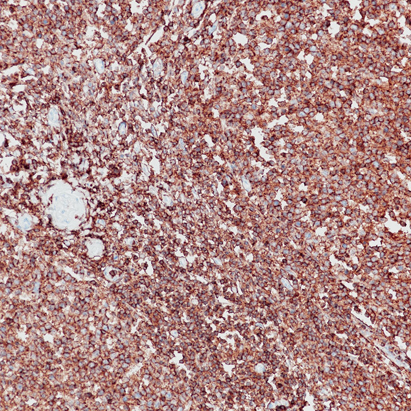 Anti-CD45 Rabbit Monoclonal Antibody