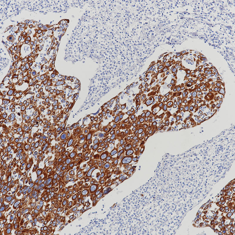 Anti-Cytokeratin 1 Rabbit Monoclonal Antibody