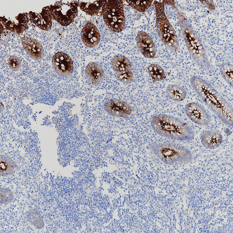 Anti-Carcino Embryonic Antigen CEA Rabbit Monoclonal Antibody