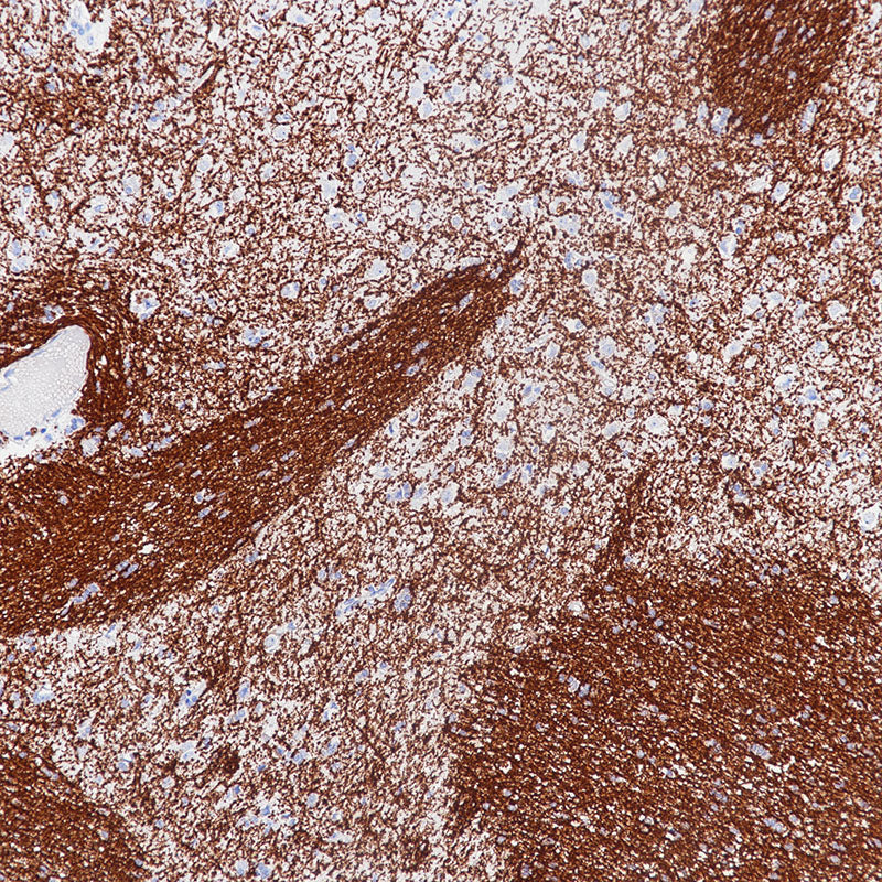 Anti-Myelin Basic Protein Rabbit Monoclonal Antibody