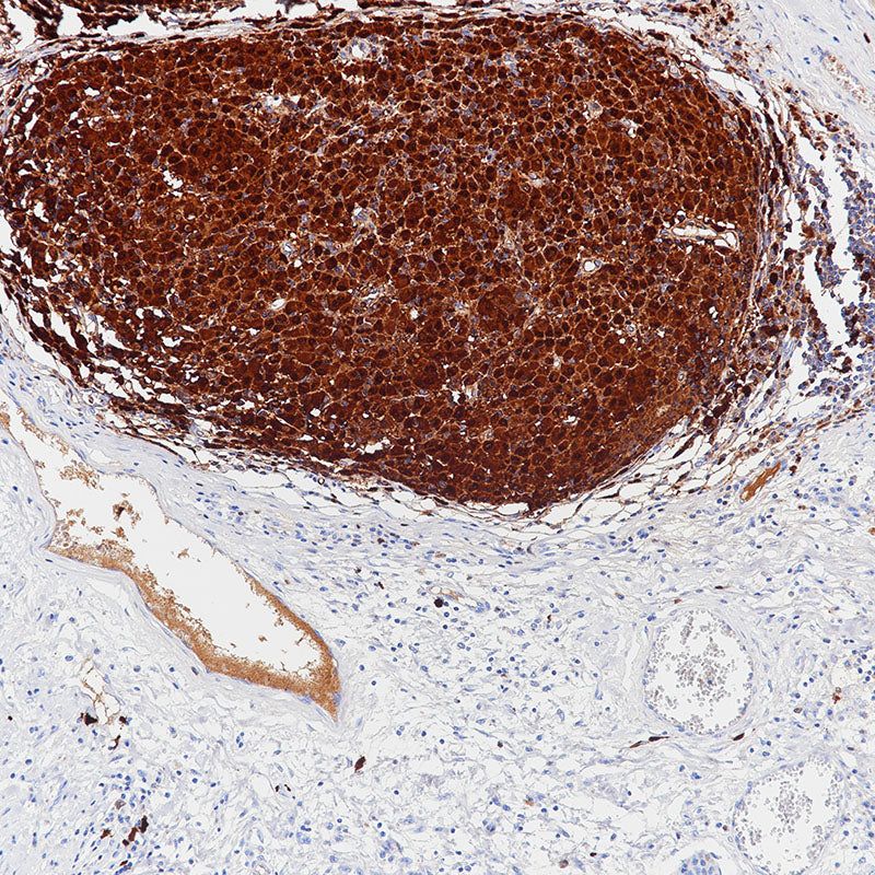 Anti-S100B Rabbit Monoclonal Antibody