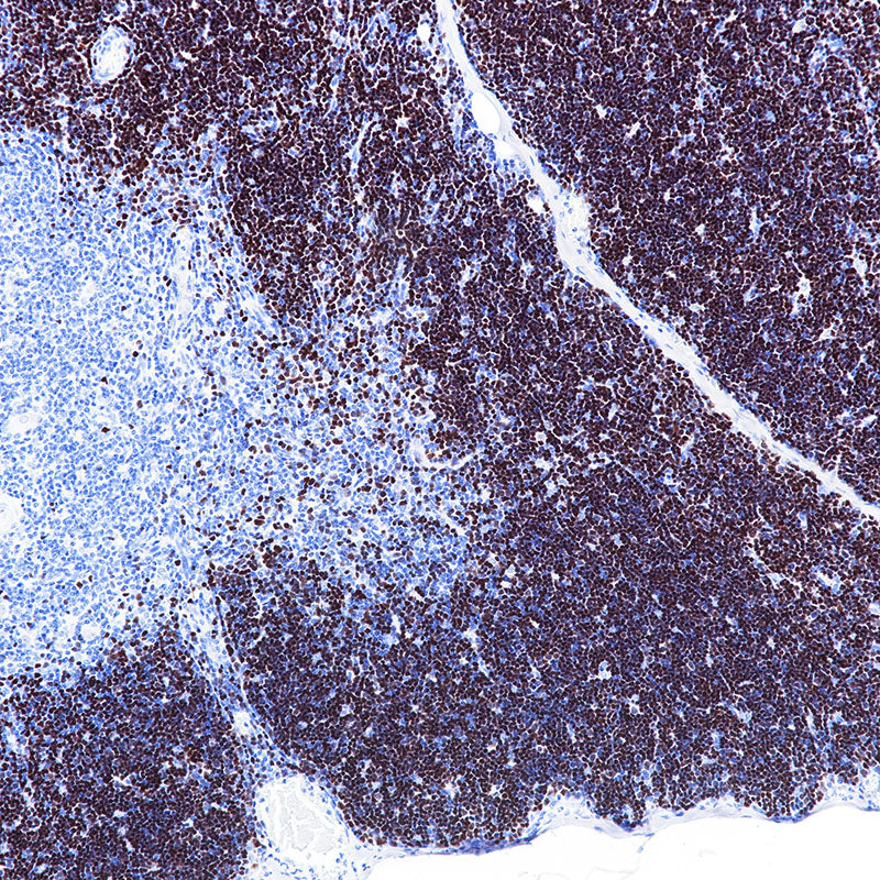 Anti-DNA Nucleotidylexotransferase/TdT Rabbit Monoclonal Antibody