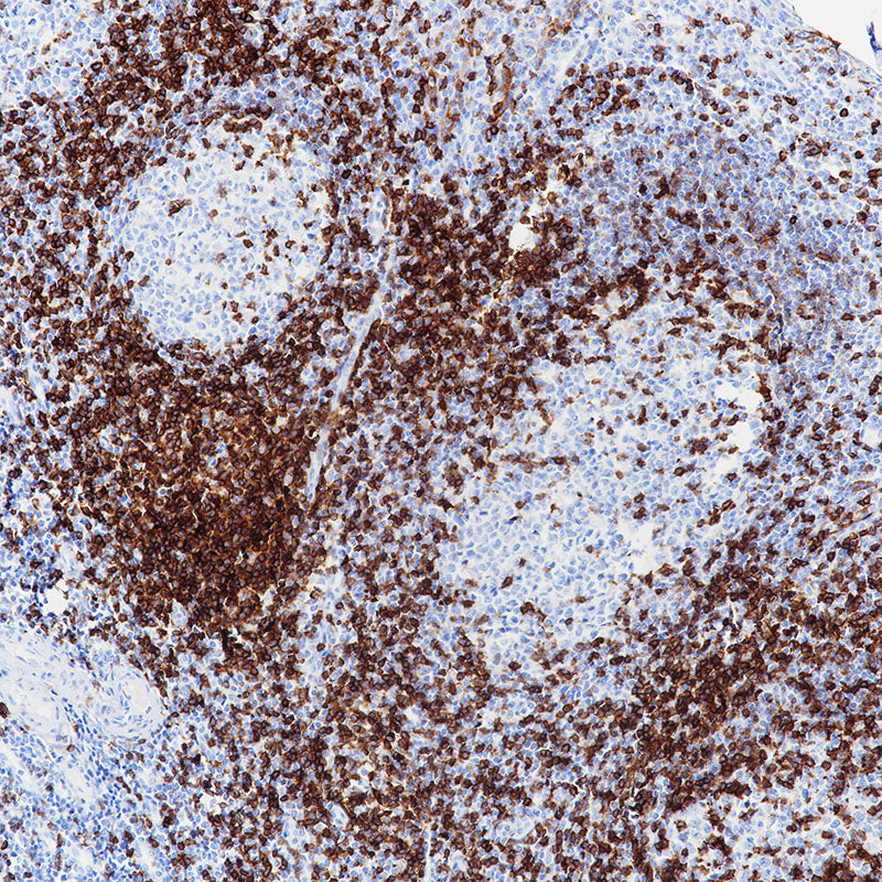 Anti-CD5 Rabbit Monoclonal Antibody