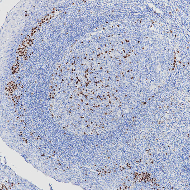Anti-MUM1 Rabbit Monoclonal Antibody
