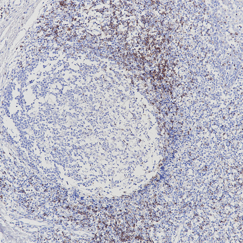 Anti-CD2 Rabbit Monoclonal Antibody