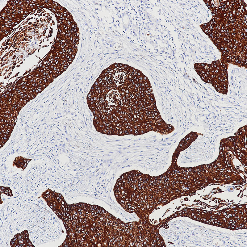 Anti-Cytokeratin 17 Rabbit Monoclonal Antibody