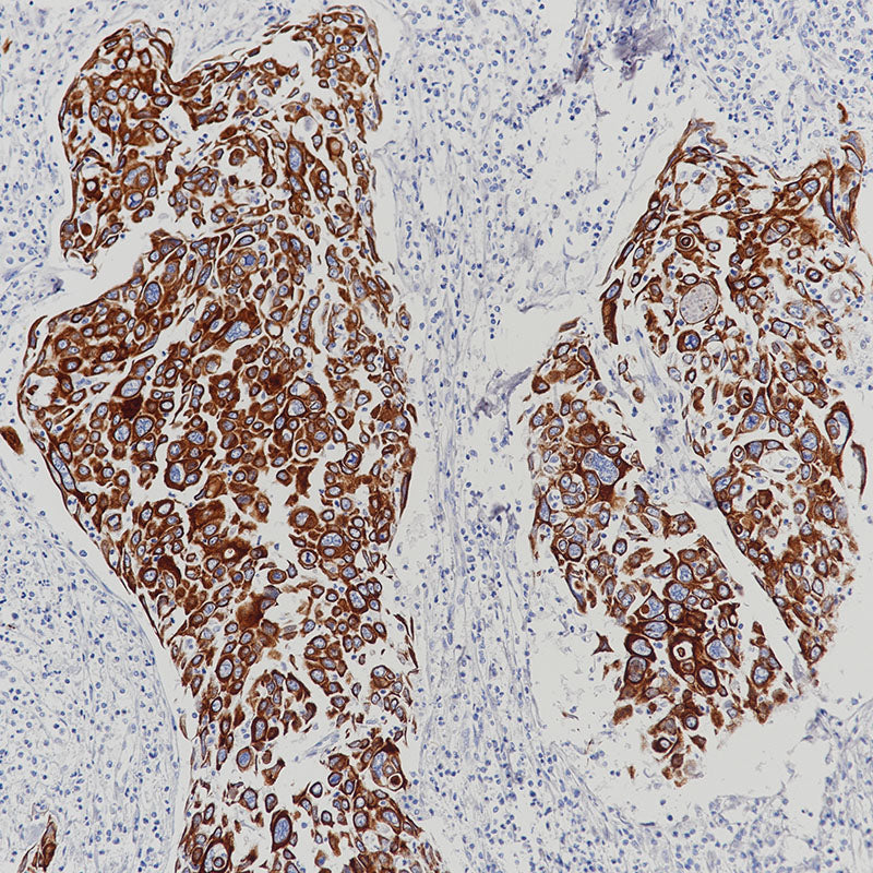 Anti-Cytokeratin HMW Rabbit Monoclonal Antibody