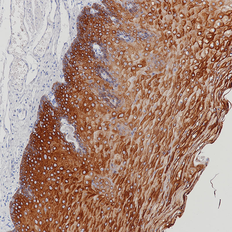 Anti-Cytokeratin HMW Rabbit Monoclonal Antibody