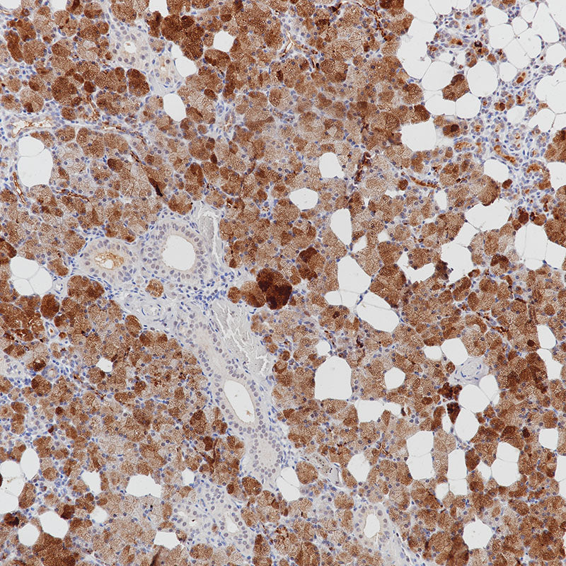 Anti-GCDFP 15 Rabbit Monoclonal Antibody