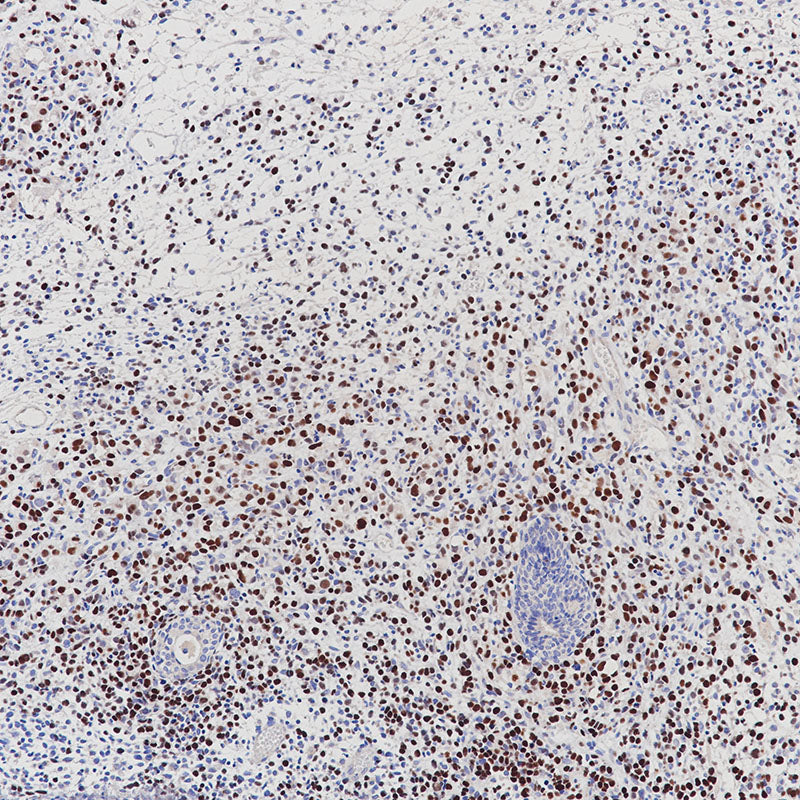 Anti-Myoblast Determination Protein 1 Rabbit Monoclonal Antibody