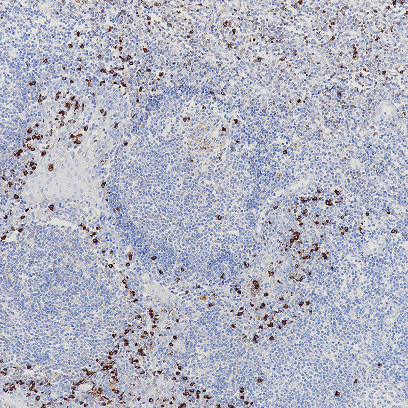 Anti-Human lambda Light Chain Rabbit Monoclonal Antibody
