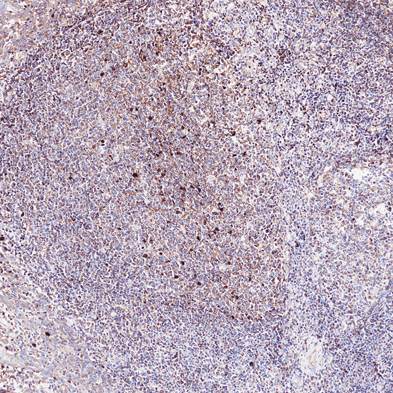 Anti-Human IgM Rabbit Monoclonal Antibody