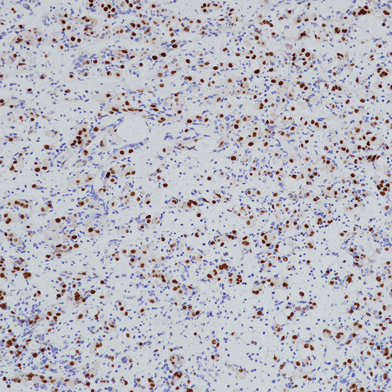 Anti-Myogenin Rabbit Monoclonal Antibody