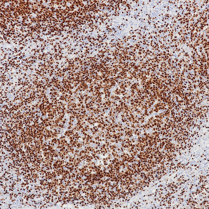Anti-PAX5 Rabbit Monoclonal Antibody