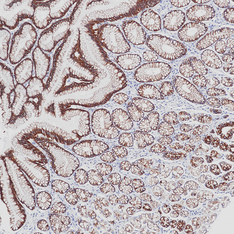 Anti-Cytokeratin pan Rabbit Monoclonal Antibody