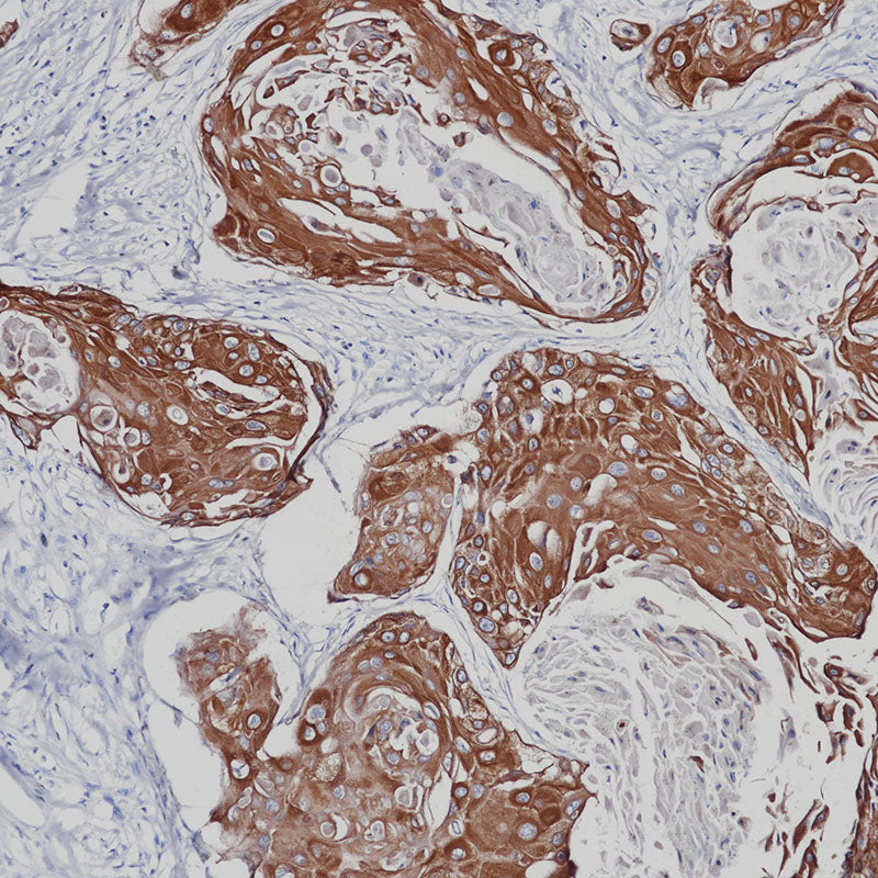 Anti-Cytokeratin 5/6 Rabbit Monoclonal Antibody