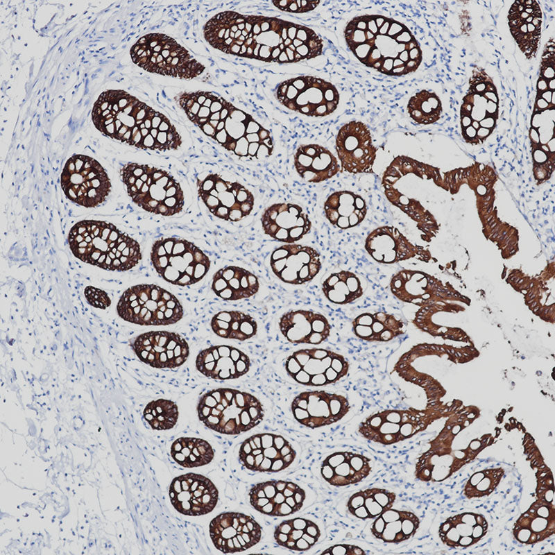 Anti-Cytokeratin 8/18 Rabbit Monoclonal Antibody