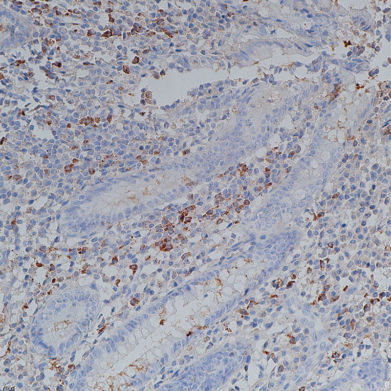 Anti-Human IgG receptor FcRn Rabbit Monoclonal Antibody