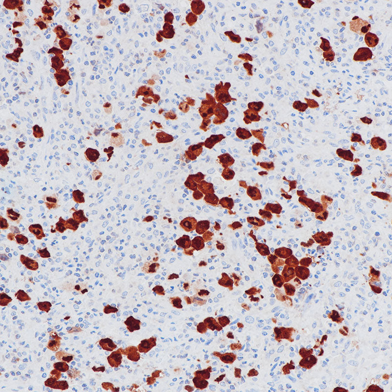 Anti-ALK Rabbit Monoclonal Antibody