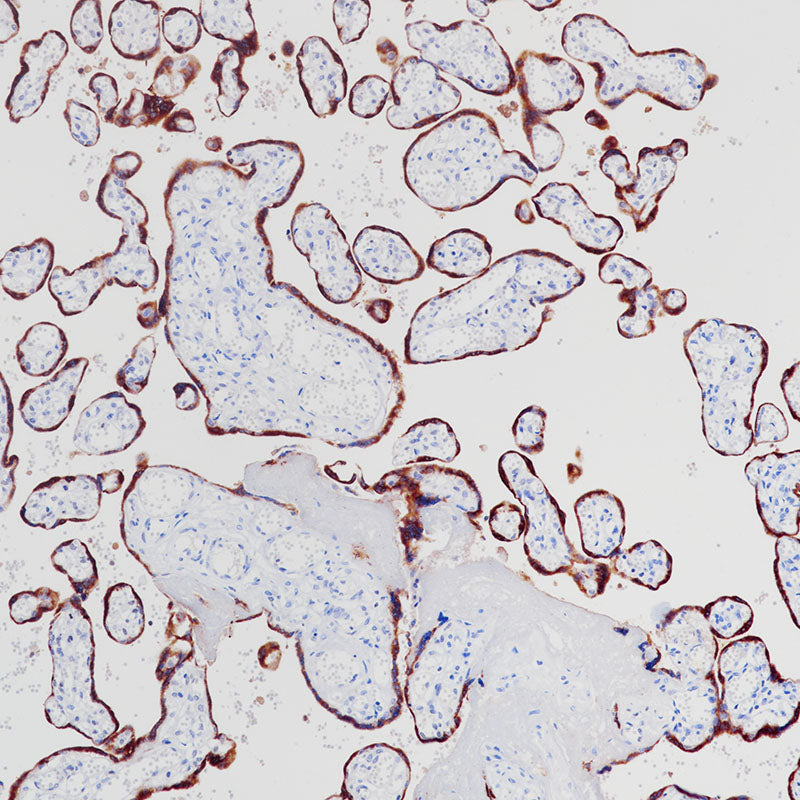 Anti-CGB3 Rabbit Monoclonal Antibody