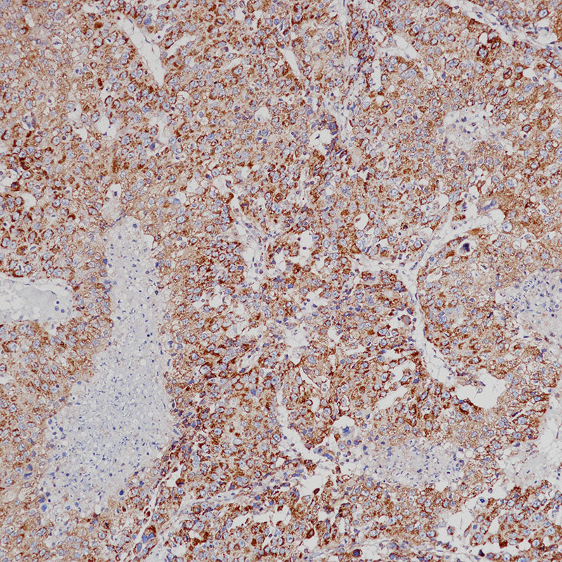 Anti-VEGFA Rabbit Monoclonal Antibody