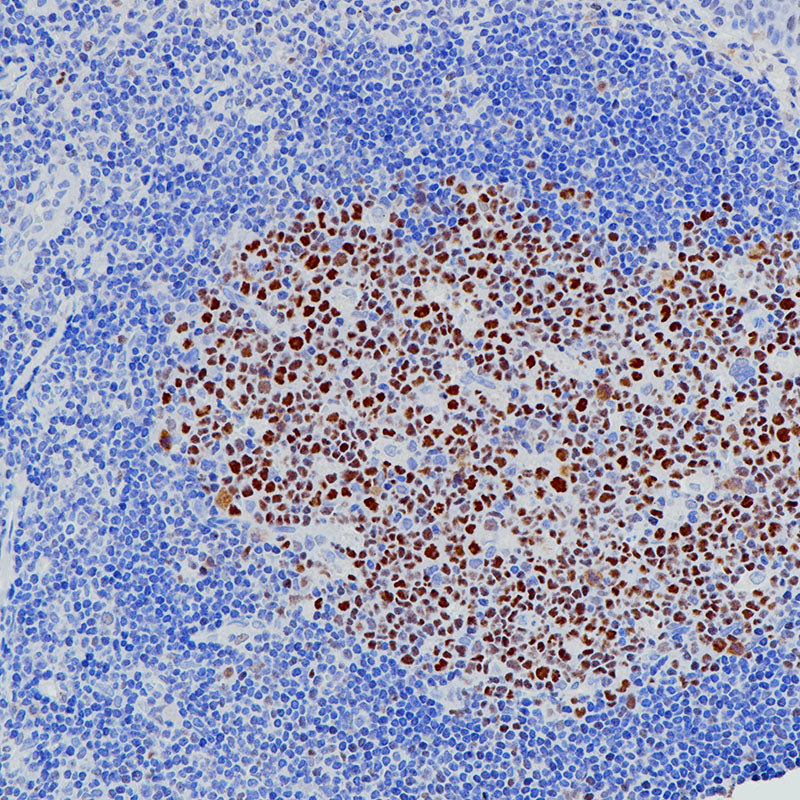 Anti-Bcl6 Rabbit Monoclonal Antibody