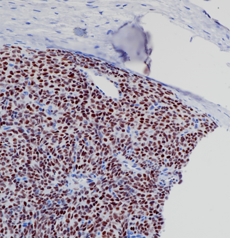 Anti-TLE1 Rabbit Monoclonal Antibody