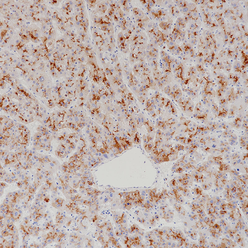 Anti-Glypican 3 Rabbit Monoclonal Antibody