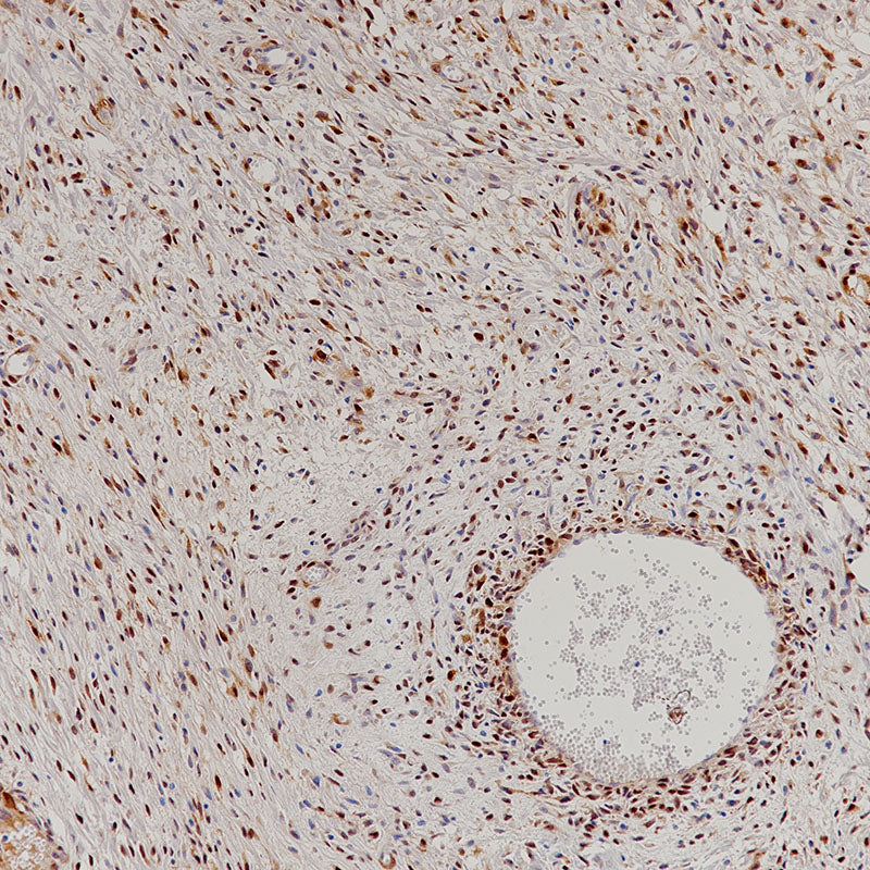 Anti-CDK4 Rabbit Monoclonal Antibody