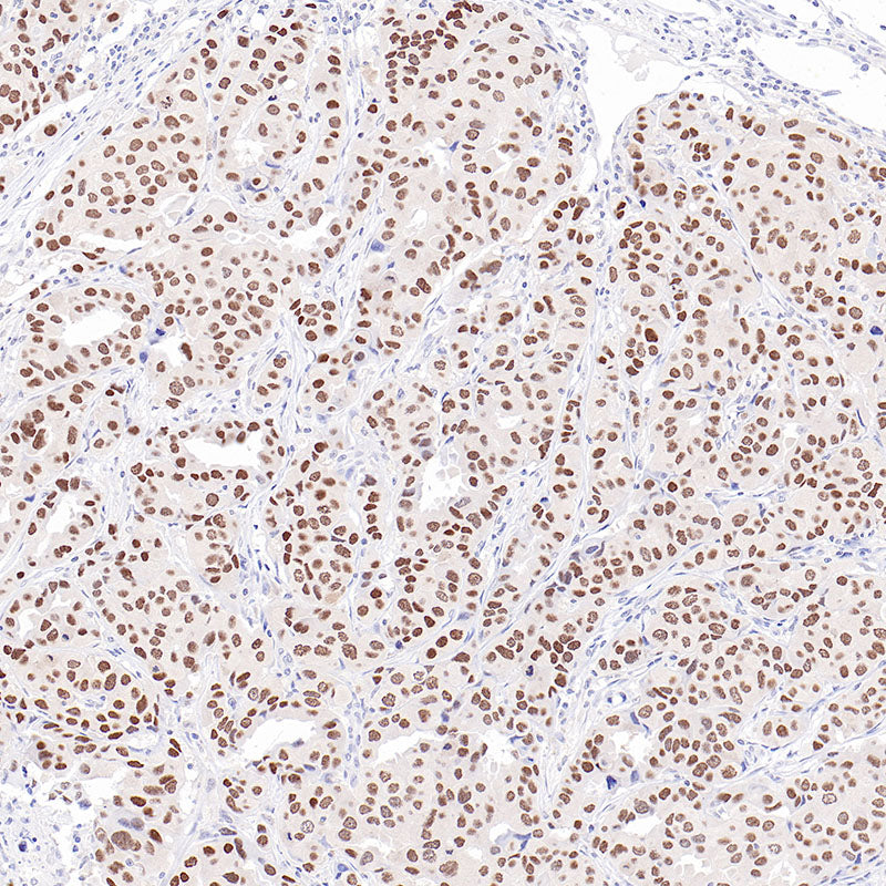 Anti-TRPS1 Rabbit Monoclonal Antibody