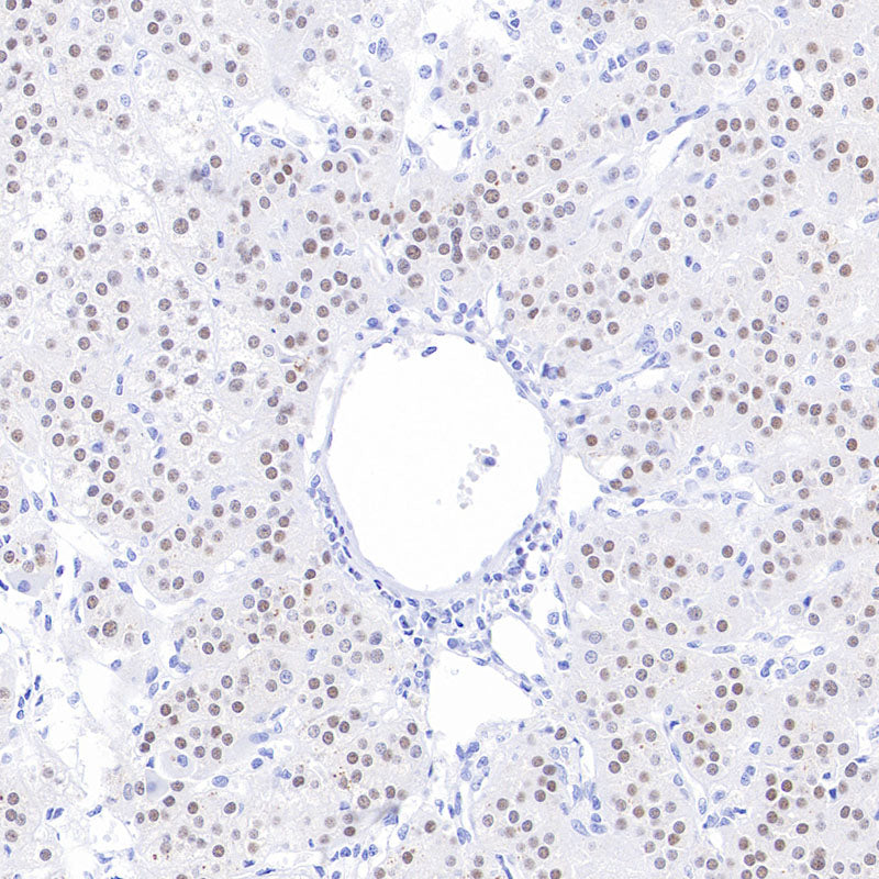 Anti-Steroidogenic Factor 1 Rabbit Monoclonal Antibody