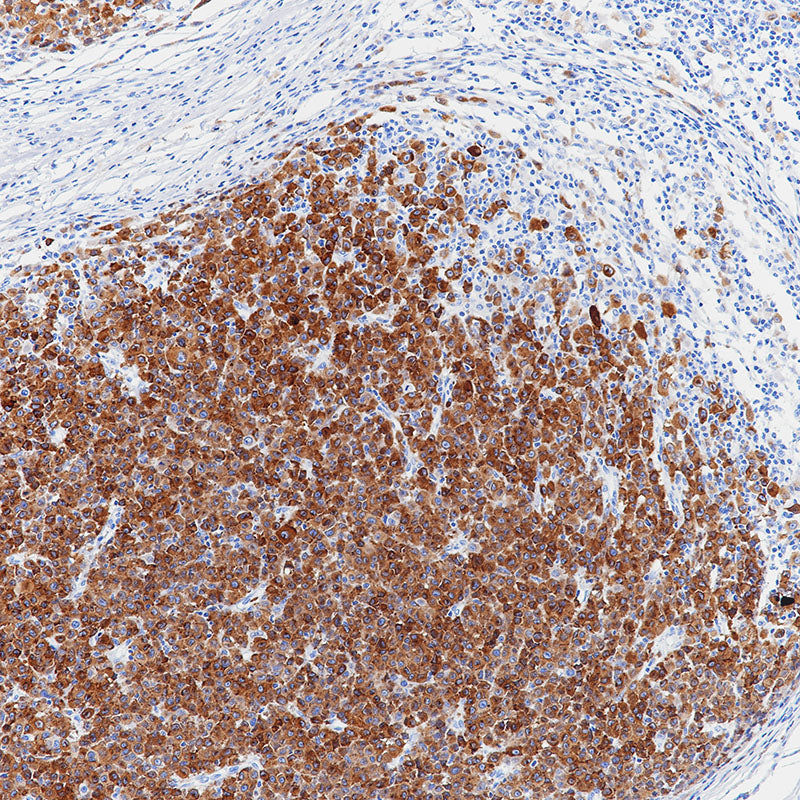 Anti-MelanA Rabbit Monoclonal Antibody