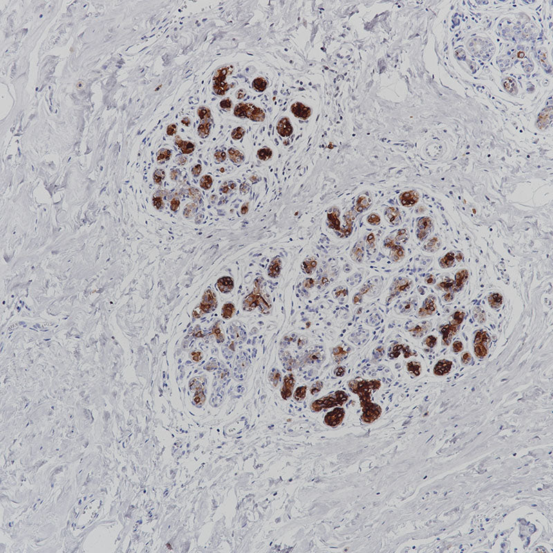 Anti-Mammaglobin A Rabbit Monoclonal Antibody