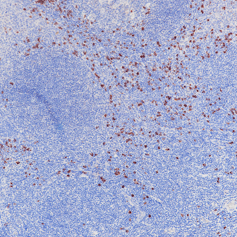 Anti-Human IgA Rabbit Monoclonal Antibody