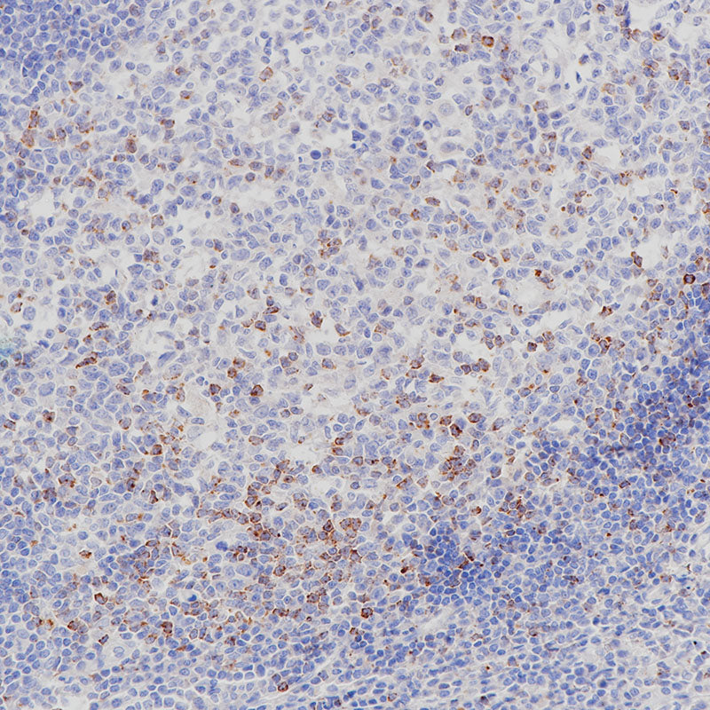 Anti-CTLA4 Rabbit Monoclonal Antibody