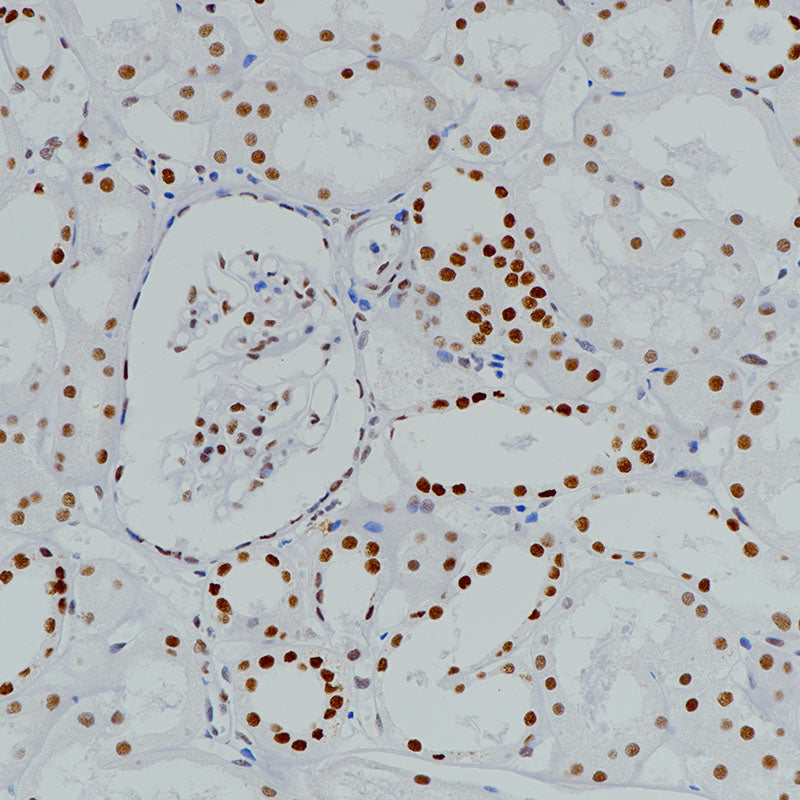 Anti-BRG1 Rabbit Monoclonal Antibody