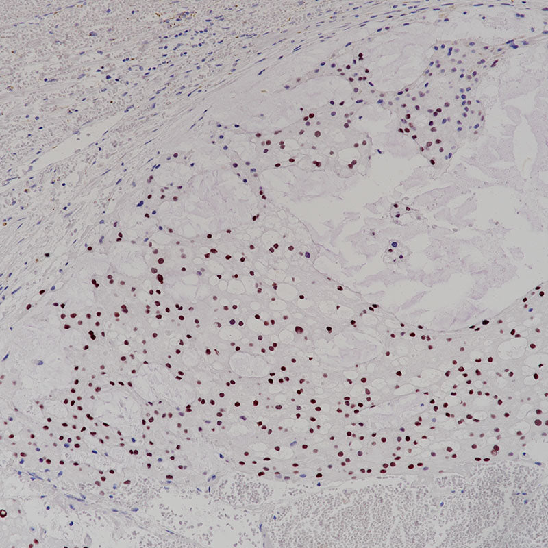 Anti-T Box Transcription Factor T Rabbit Monoclonal Antibody