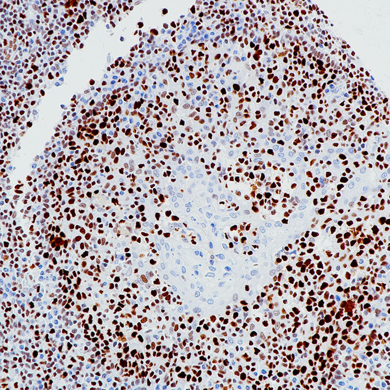 Anti-MCM2 Rabbit Monoclonal Antibody