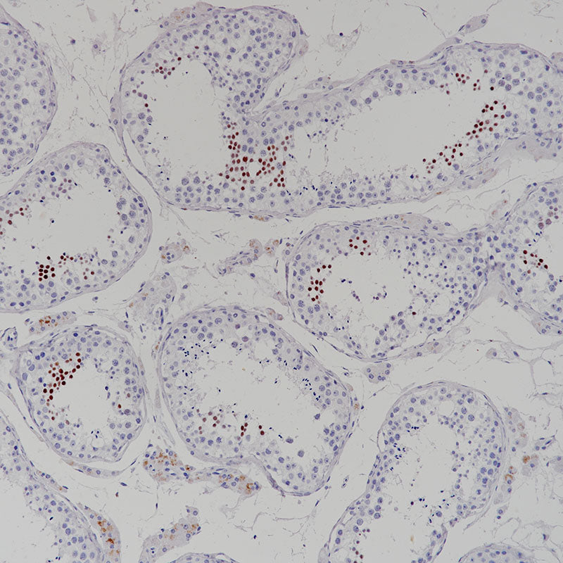 Anti-NUT Rabbit Monoclonal Antibody