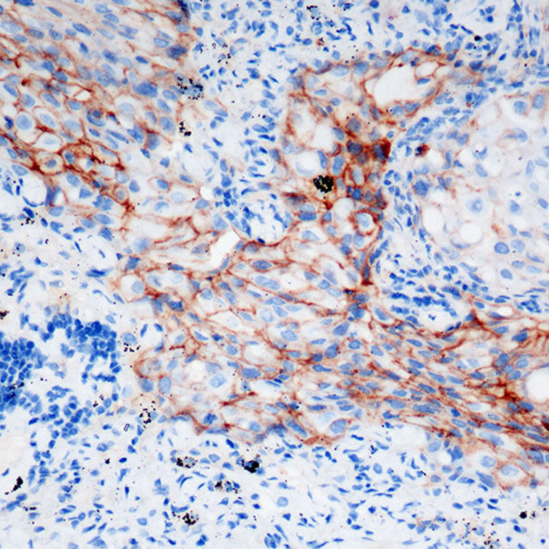 Anti-PD-L1 Rabbit Monoclonal Antibody
