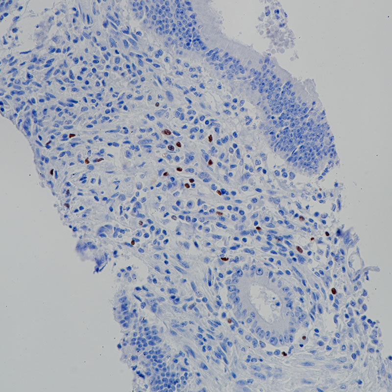 Anti-FOXP3 Rabbit Monoclonal Antibody