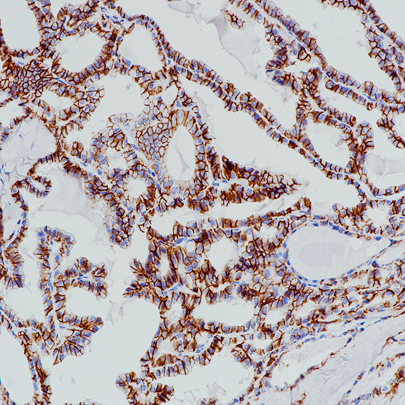 Anti-TACSTD2 Rabbit Monoclonal Antibody