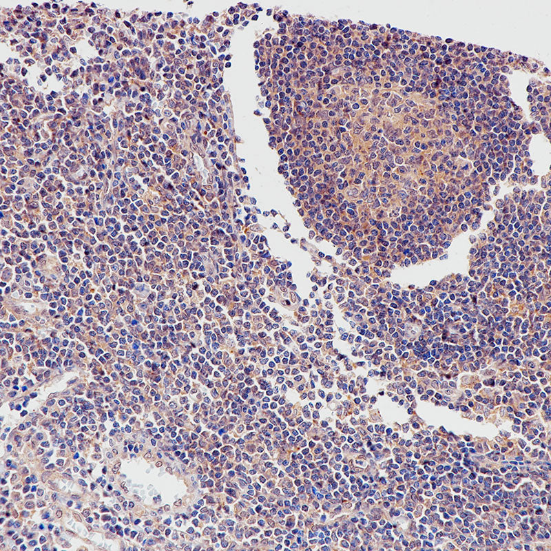 Anti-Smad4 Rabbit Monoclonal Antibody