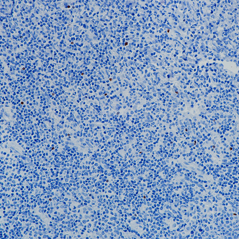 Anti-ROR gamma T Rabbit Monoclonal Antibody