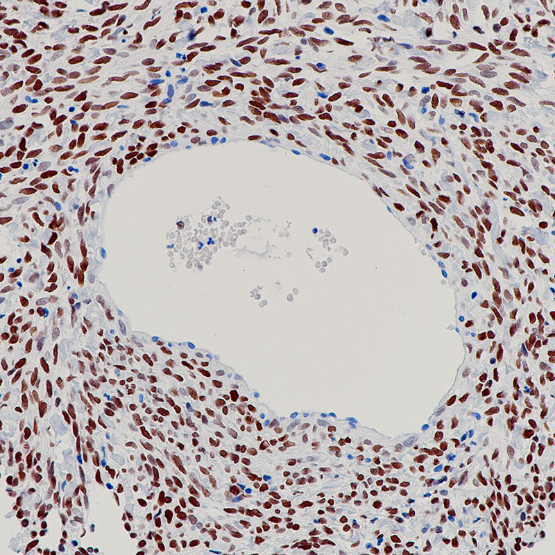 Anti-FOXL2 Rabbit Monoclonal Antibody