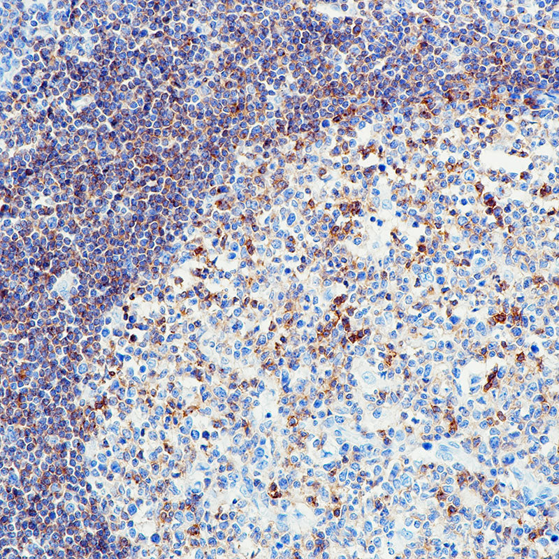 Anti-CXCR5 Rabbit Monoclonal Antibody