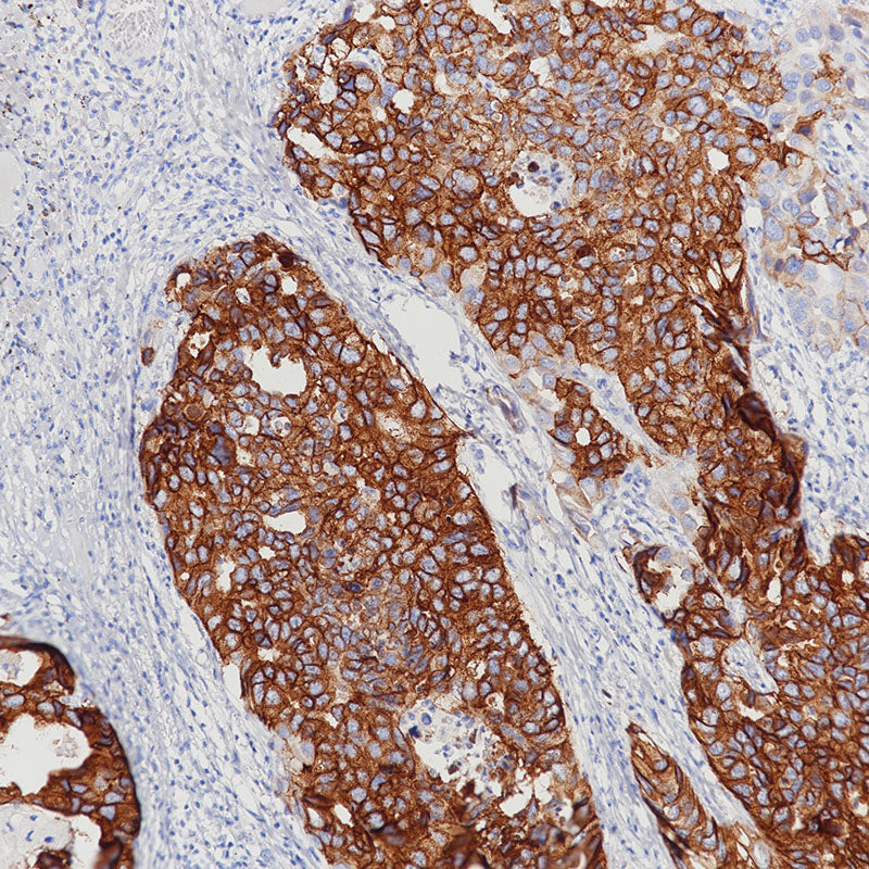 Anti-EGFR (L858R) Rabbit Monoclonal Antibody