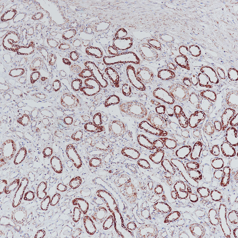 Anti-SDHB Rabbit Monoclonal Antibody